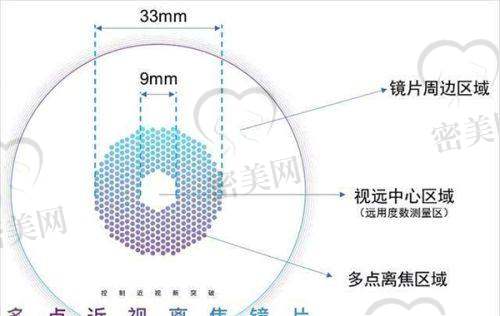 重庆南坪爱尔眼科配镜及儿童近视防控服务介绍