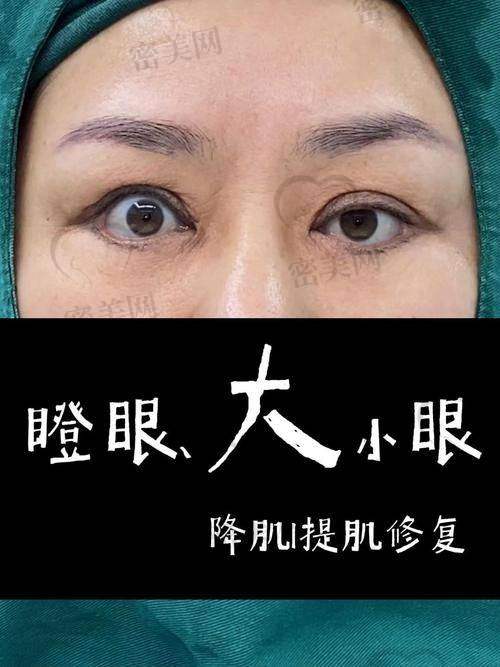 上海艺星助力许炎龙：眼修复背后的强大后盾
