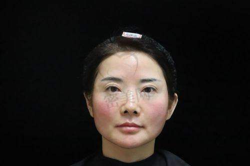 总结一下