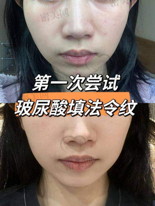 医美机构活动：薅羊毛的好时机