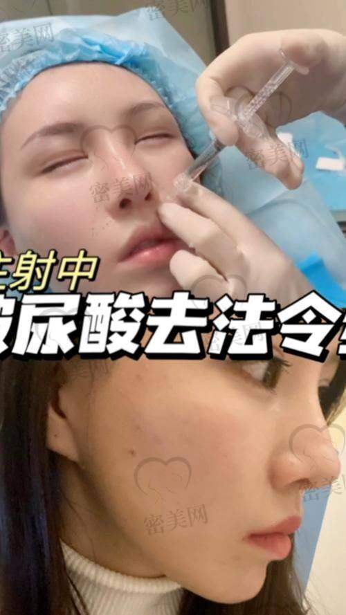 优选整形医院：各有各的“拿手好戏”