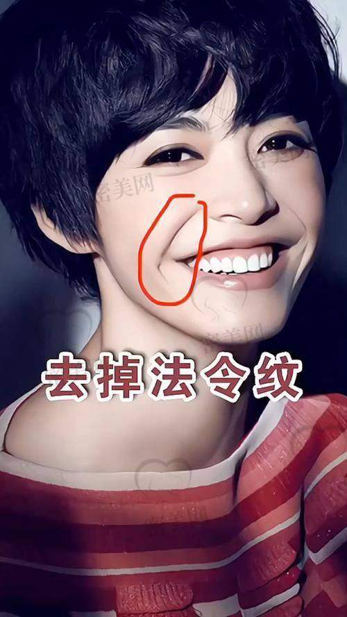 整形攻略：选对医院和医生特别重要