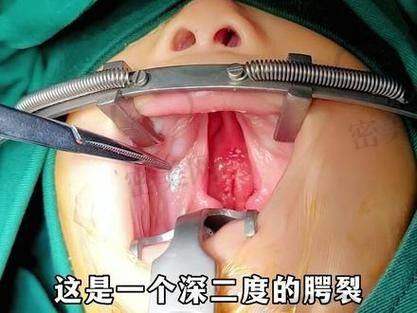 怎么预约余文林医生？附带实用挂号小提示