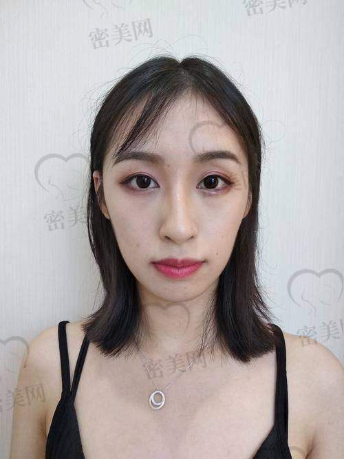 面诊：和刘李娜医生的奇妙邂逅