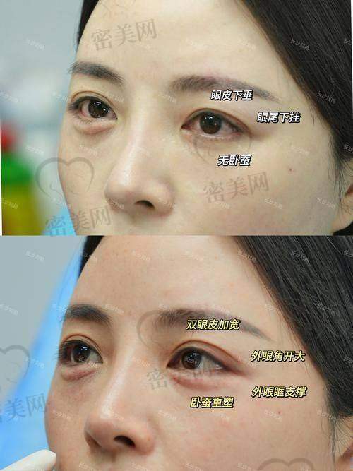 修复过程是啥样的？