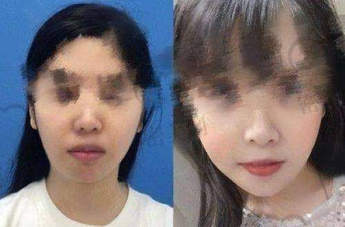 医生团队推荐与到院攻略