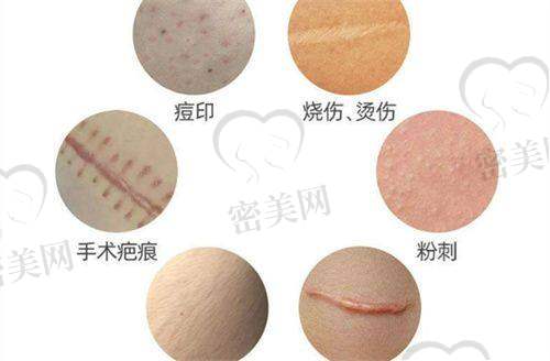 张光泽医生荣誉资质：