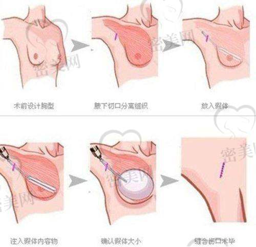 陈丽勇医生口碑怎么样？