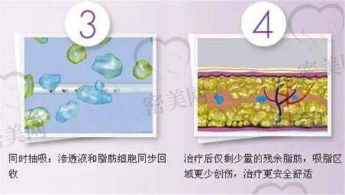 林峰医生荣誉资质：