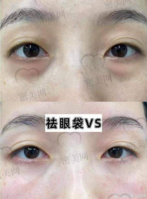 北京轻美颜医疗美容诊所价格表：