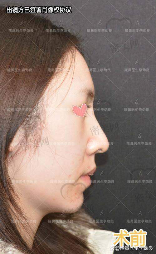上海伯思立整形徐文龙：医生魅力大展现