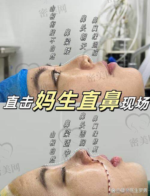 上海伯思立整形周珍艳：40000起的鼻修复价格有多香？