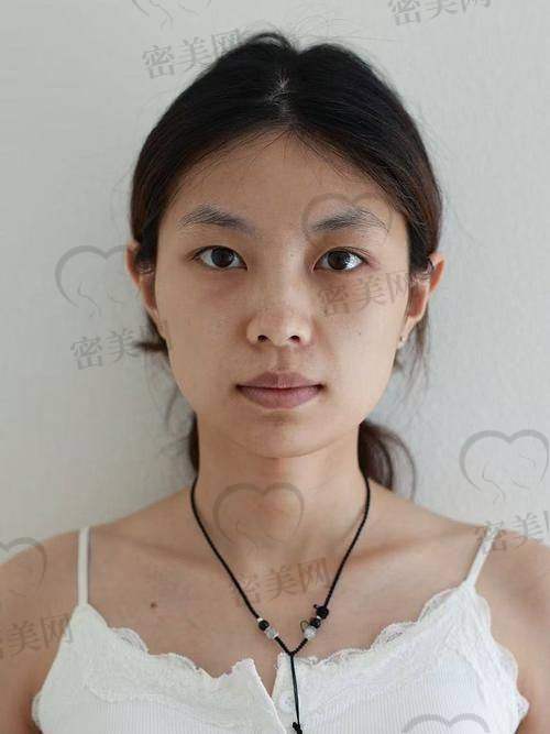 上海时光整形何晋龙口碑如何？