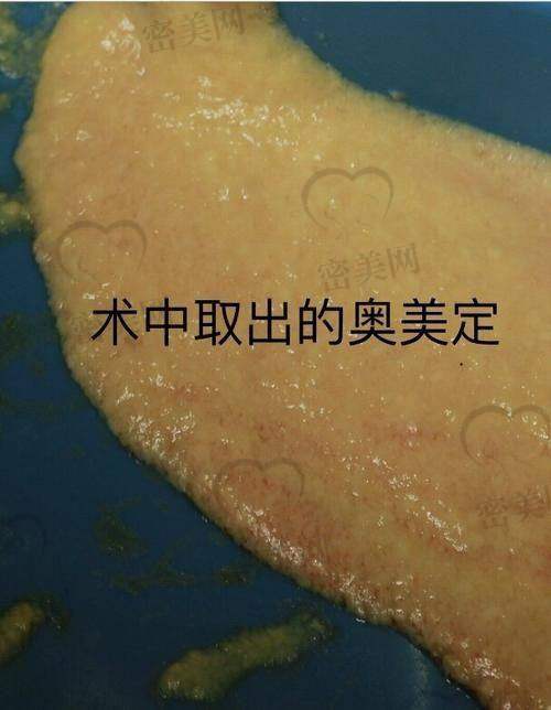 广州齐云香奥美定取出价格参考