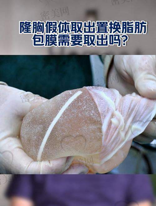 注射式隆胸的其他风险与注意事项