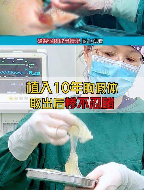 能不能取出注射材料呢？