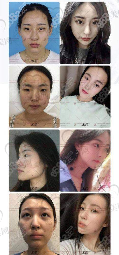 何晋龙医生口碑怎么样？成功实例来说话