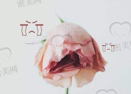 刘歆医生技术特点：
