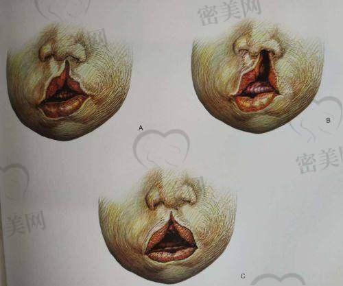 张宏医生怎么预约挂号？