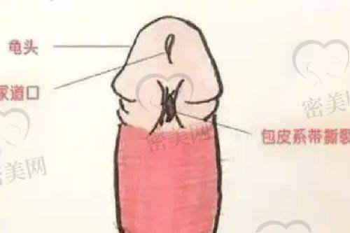 张效恩医生擅长项目：