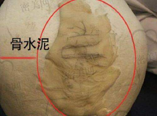 刘近兰医生荣誉资质：