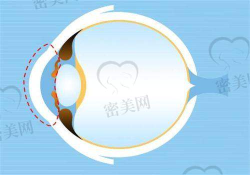 成都/广州/上海等城市分院价格参考：国内价格基本持平