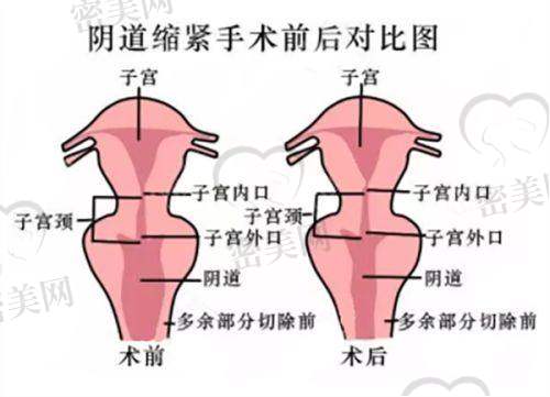 李灿灿医生擅长项目：