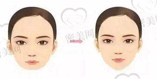 路卫国医生技术特点：