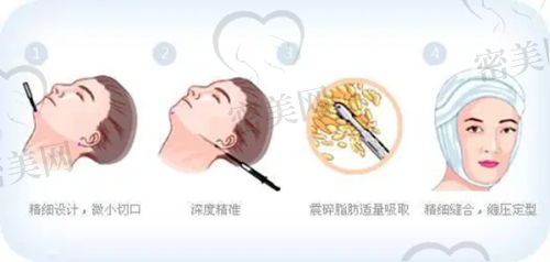 王克华医生怎么预约挂号？