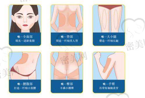 术杰医生口碑怎么样？
