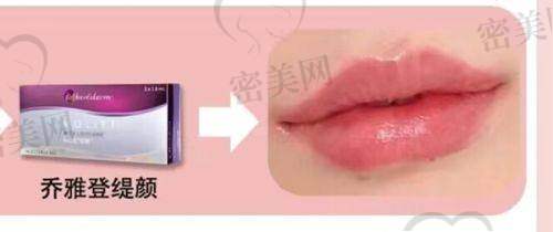 术后注意事项：这些事儿得牢记