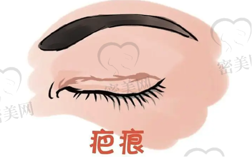 周娇医生擅长项目：