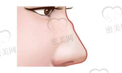 周娇医生口碑怎么样？