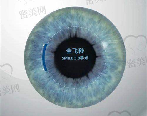 设备精良，配置堪比三等级医院眼科中 心