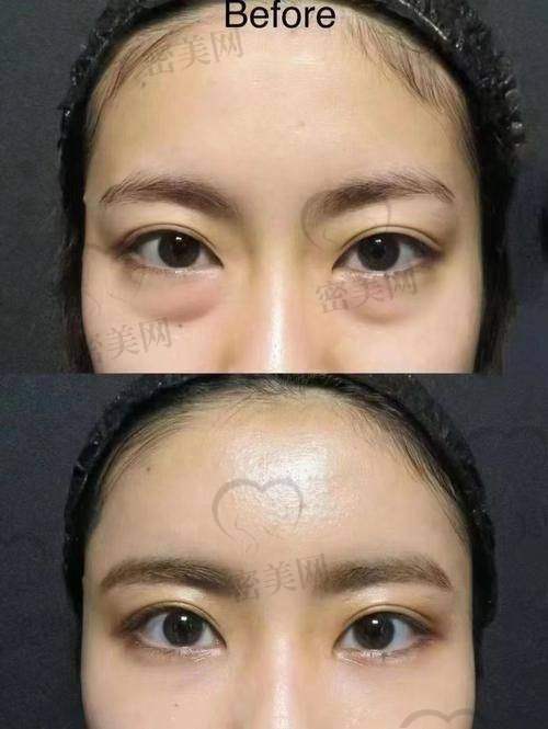 面诊细节令人惊喜：医生经验多，方案个性化