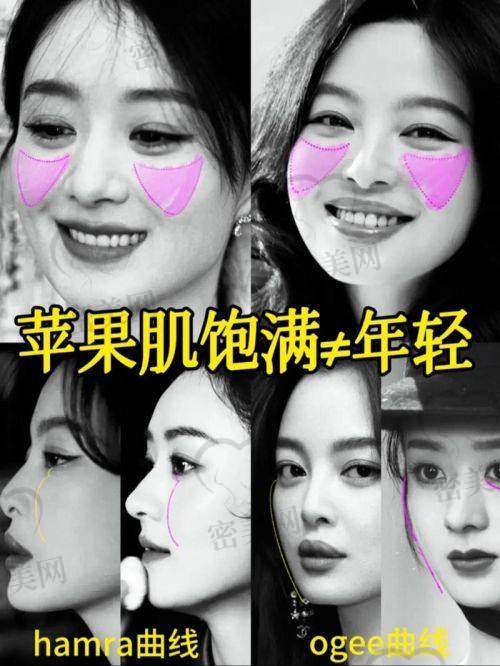 整形医院活动补贴多