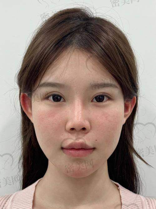 哲晨子玻尿酸医院/医生推荐点评——来自行业内部视角