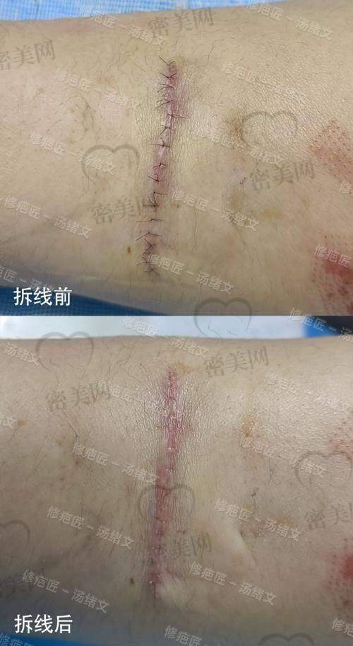 哈尔滨欧华医疗美容诊所——王迪医生