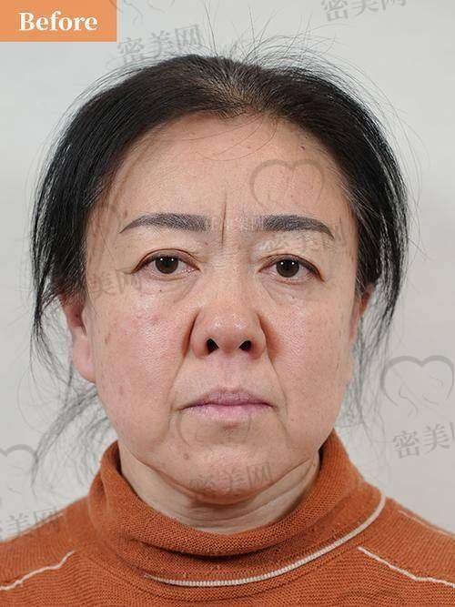 如何选择靠谱的医院和医生