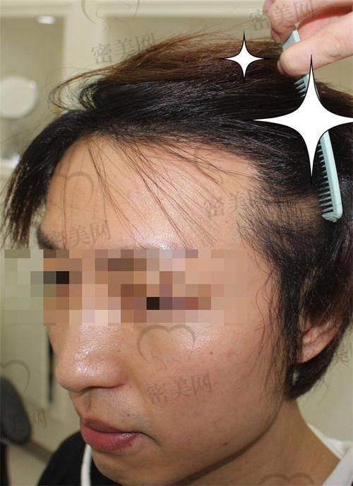 珠海碧莲盛植发医院地址在哪？交通便利到院更轻松