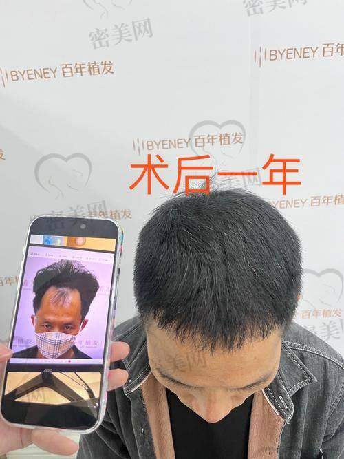 医生团队实战经验多，术后安心有保护