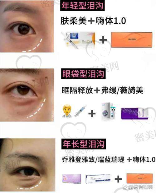 按摩手法消除泪沟