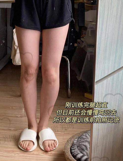 上海丽质整形美容医院卢九宁直腿术：优势大揭秘