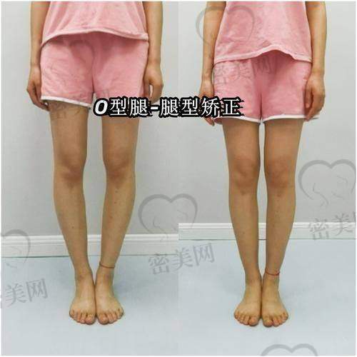 卢九宁医生：美腿魔法师的传奇之路