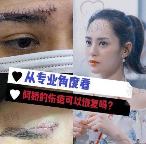 上海海华医院安洪宾眼周手术：口碑爆棚的秘密