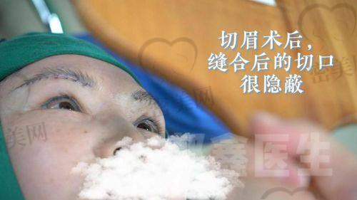 上海海华医院：眼周年轻化手术的理想之选