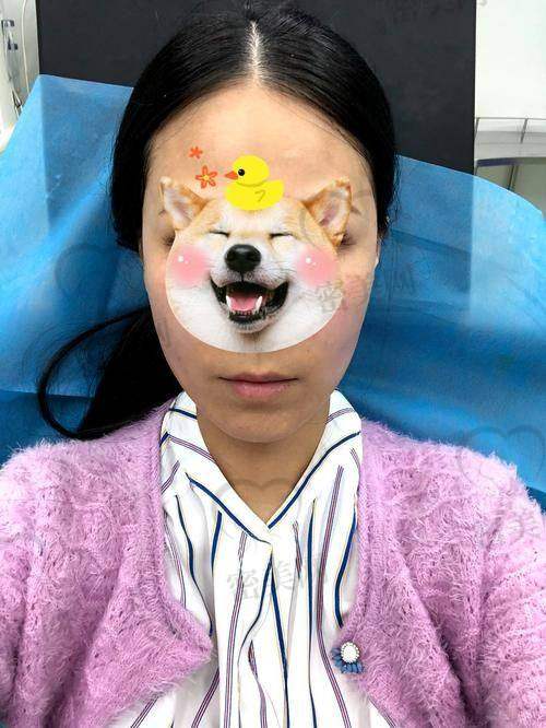 整形面部填充多少钱？