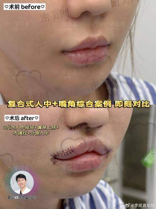 上海丽质卢九宁：技术不错的变得更美魔法师