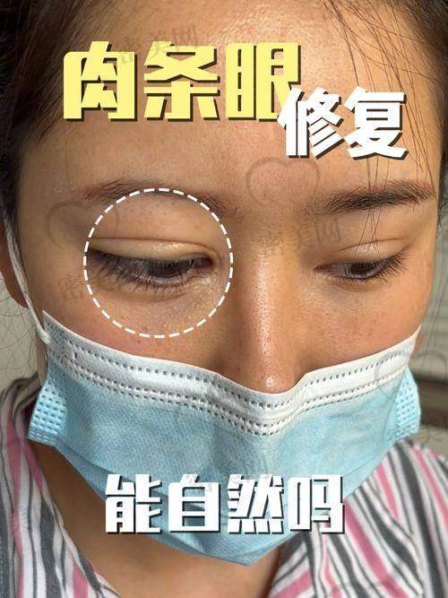 孙玮奇医生在初眼与修复手术上的表现对比