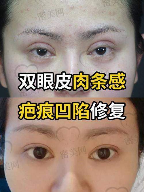王衡健双眼皮修复技术优势：“魔法技能”大揭秘
